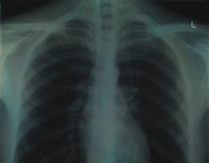 1438611641_d4b2e02072_z